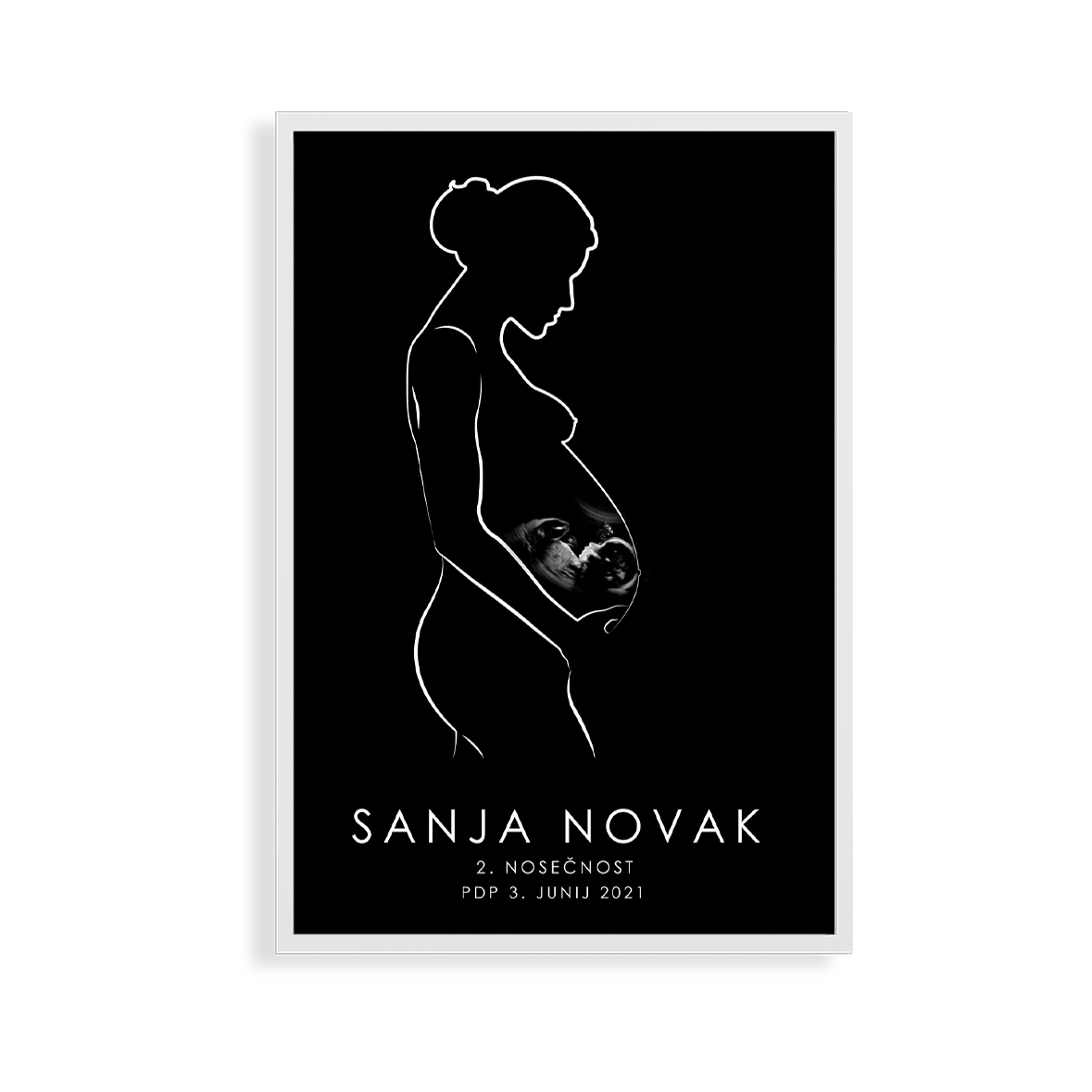 Digitalni print LEPOTA ROJSTVA